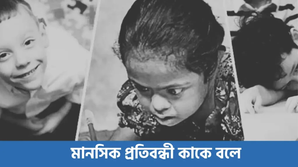 মানসিক প্রতিবন্ধী কাকে বলে